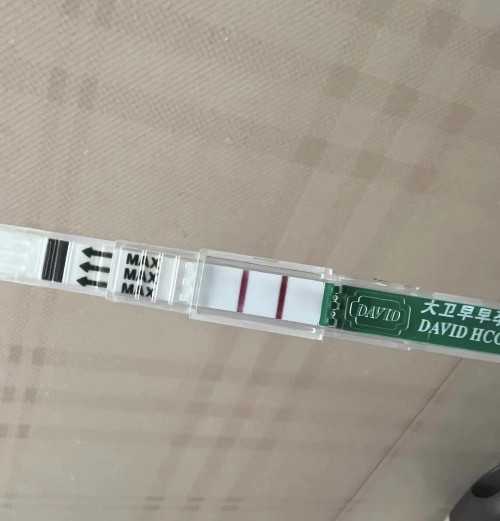 阴道炎：警惕潜在危害，把握防治关键！