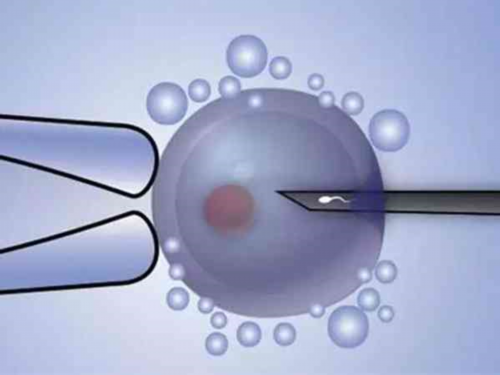 上海私立代妈代生贵不贵-上海代妈代生贵不贵私人医院